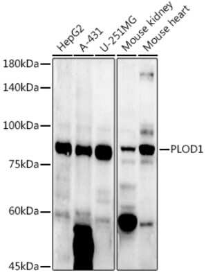 Western Blot: PLOD1 Antibody [NBP2-93608] - Western blot analysis of extracts of various cell lines, using PLOD1 antibody (NBP2-93608) at 1:1000 dilution. Secondary antibody: HRP Goat Anti-Rabbit IgG (H+L) at 1:10000 dilution. Lysates/proteins: 25ug per lane. Blocking buffer: 3% nonfat dry milk in TBST. Detection: ECL Enhanced Kit. Exposure time: 180s.